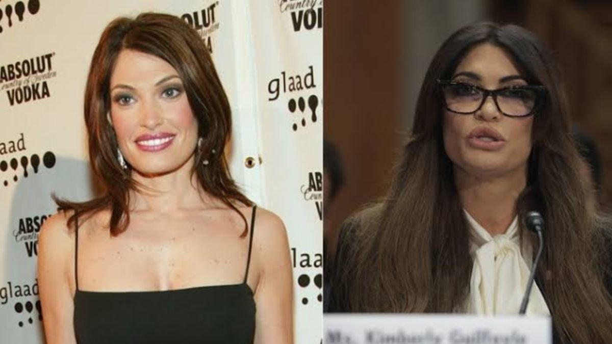 kimberly guilfoyle before and after